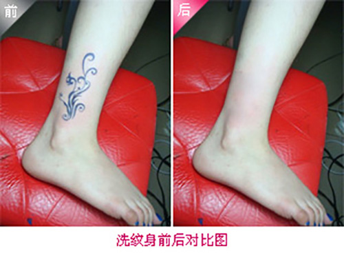 before,aftert200.jpg