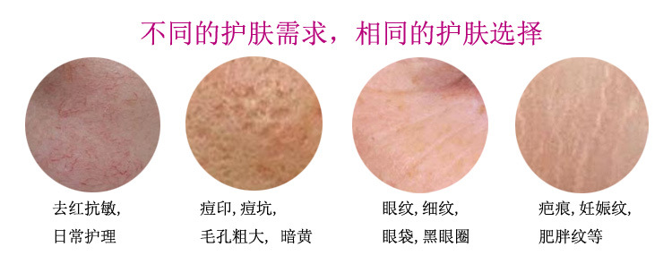 Beauty Equipment