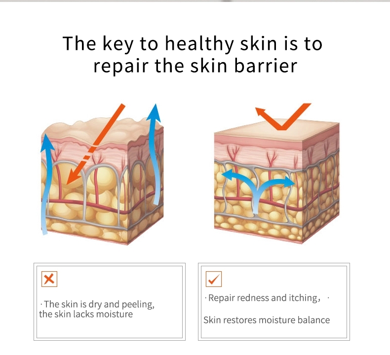 Beauty Equipment
