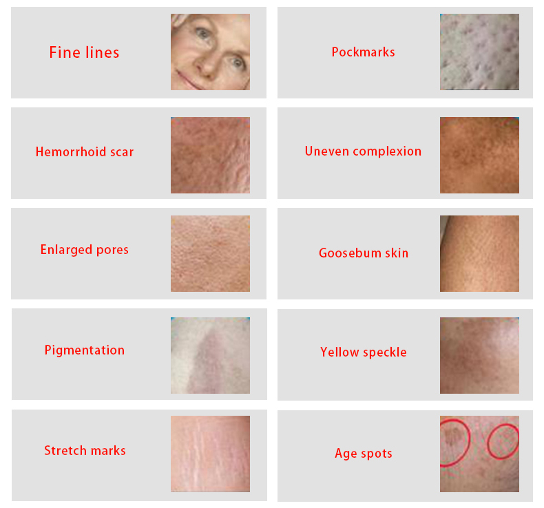 Beauty Equipment