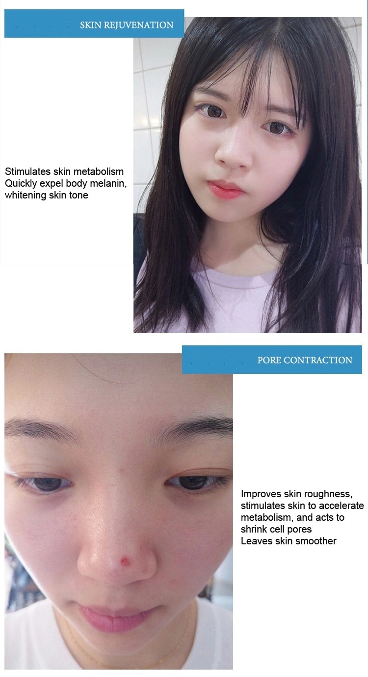 Beauty Equipment