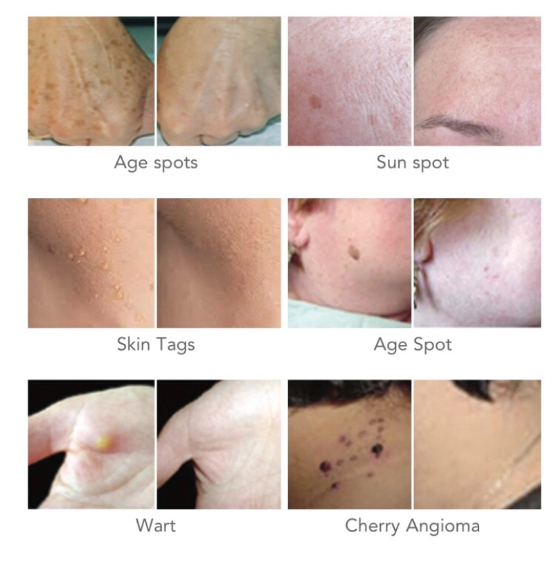 Beauty Equipment