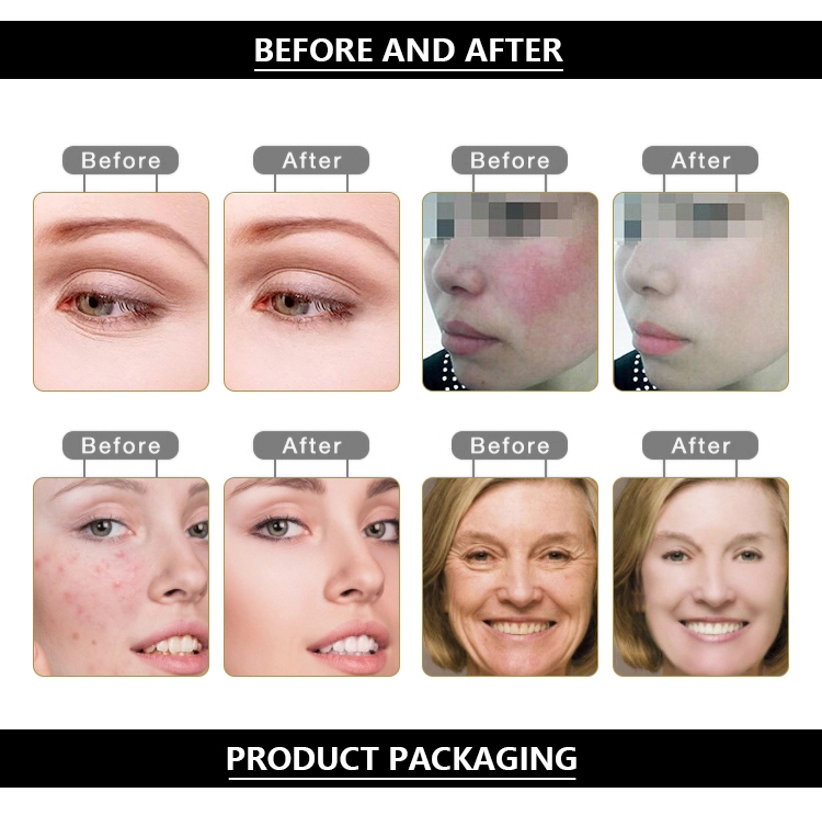 Beauty Equipment