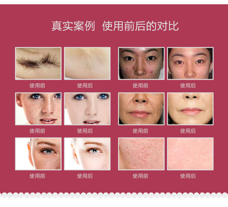 Beauty Equipment