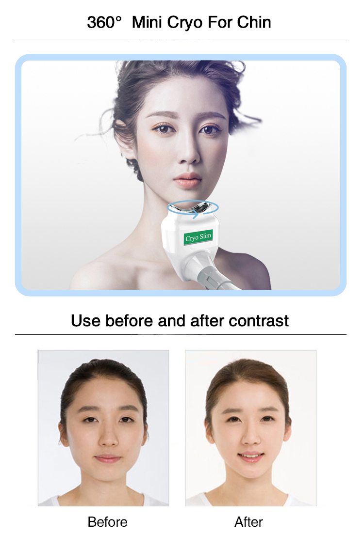 Beauty Equipment