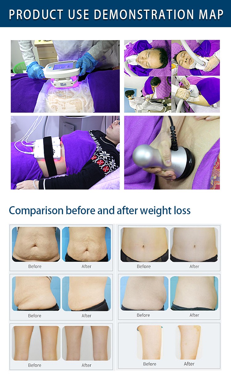 Beauty Equipment