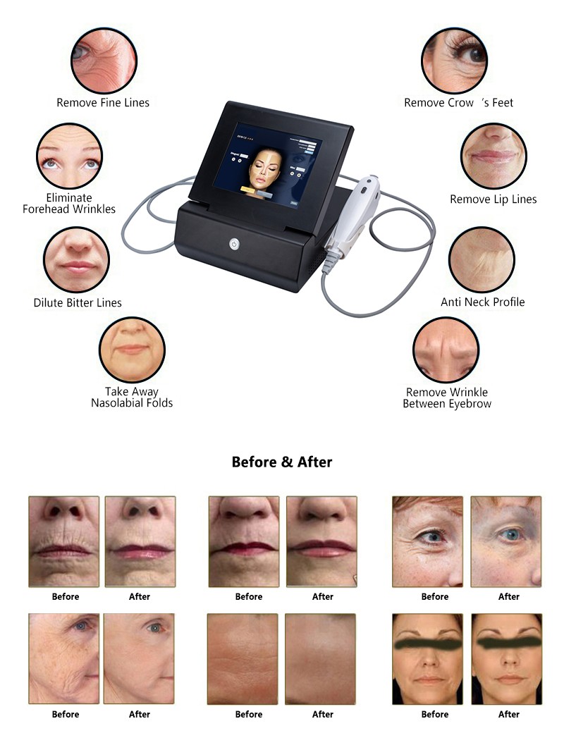 Beauty Equipment