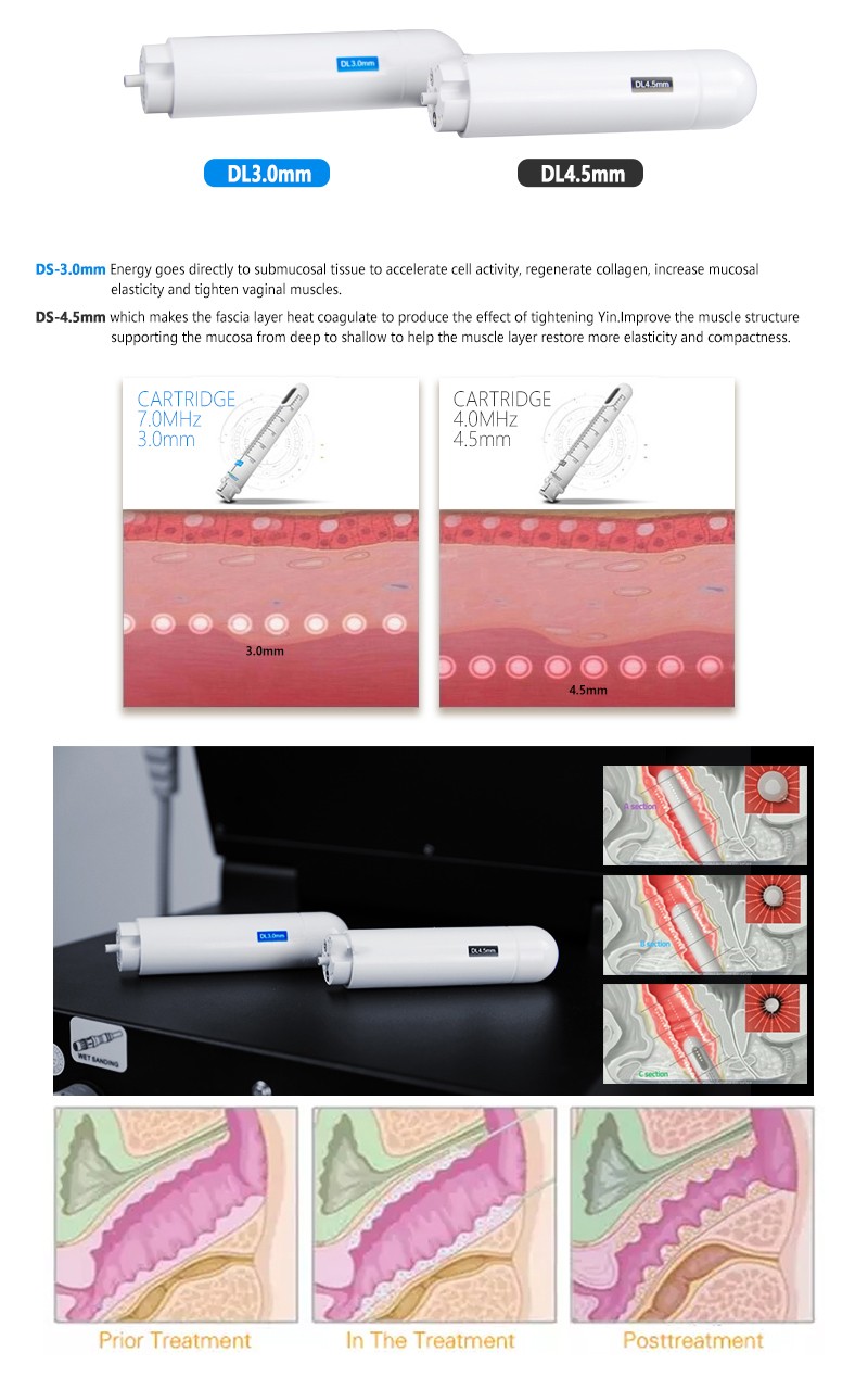 Beauty Equipment