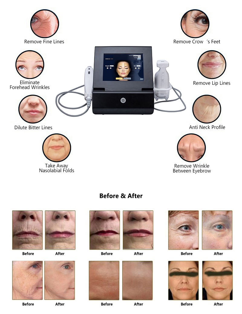 Beauty Equipment