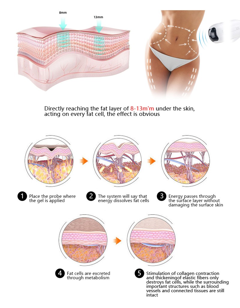 Beauty Equipment