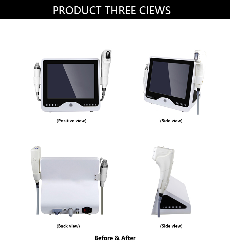 Beauty Equipment
