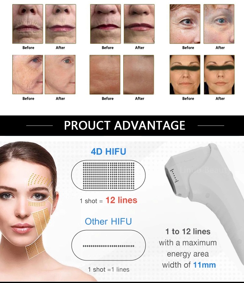 Beauty Equipment