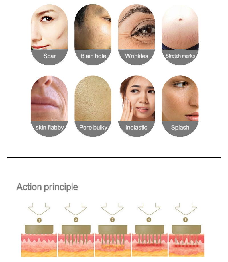 Beauty Equipment