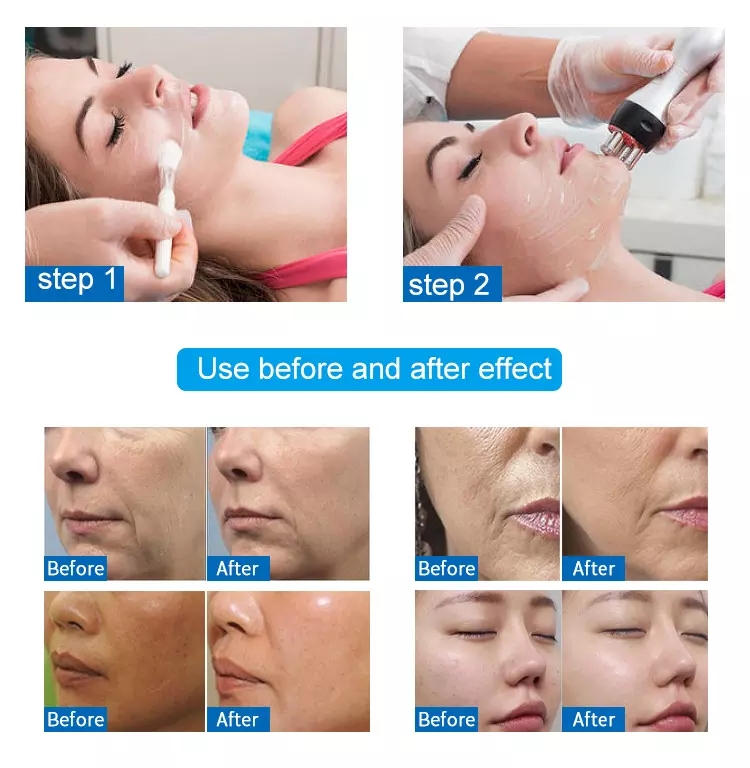 Beauty Equipment