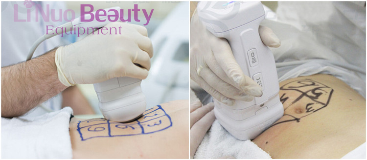 Beauty Equipment