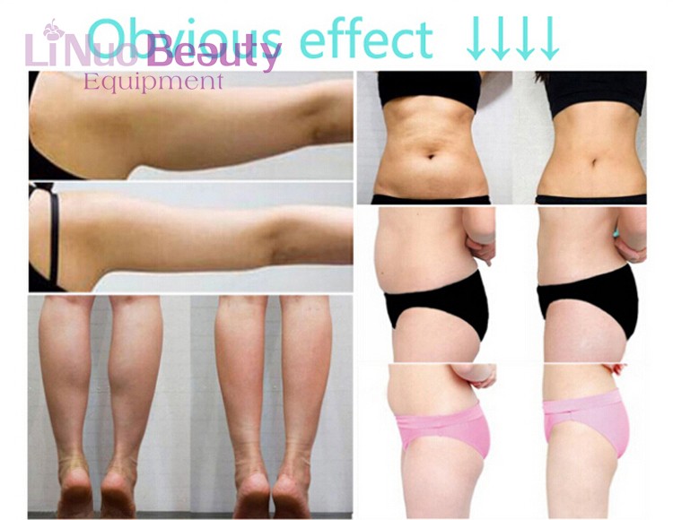 Beauty Equipment