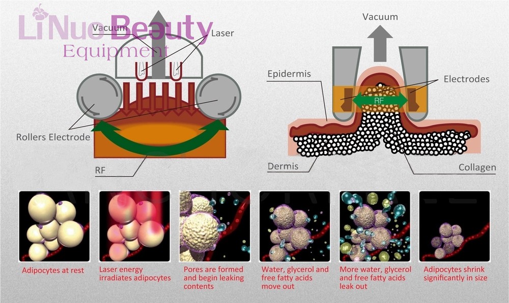 Beauty Equipment