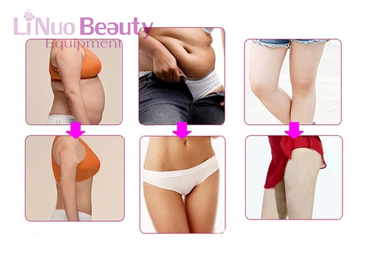 Beauty Equipment