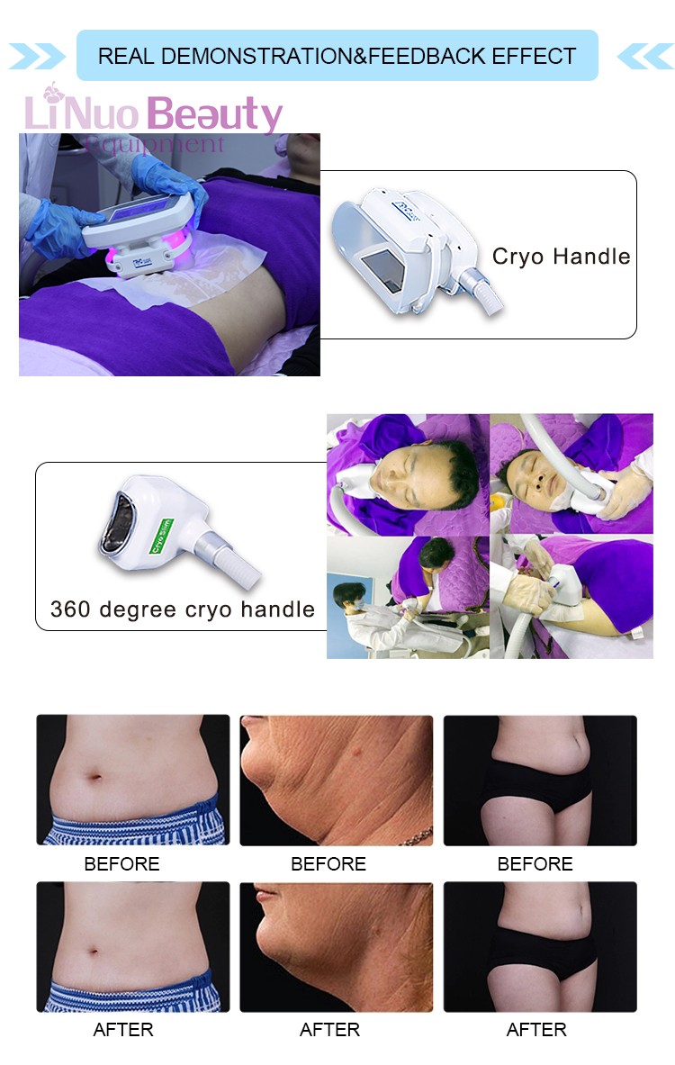 Beauty Equipment