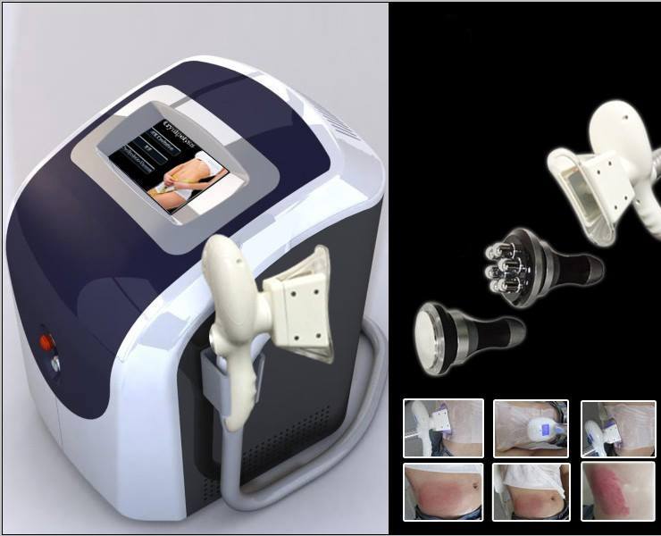Beauty Equipment